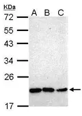 Anti-NKX2.8 antibody [N1C2] used in Western Blot (WB). GTX101580