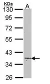 Anti-LEFTY2 antibody used in Western Blot (WB). GTX101582