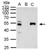Anti-PAX8 antibody used in Immunoprecipitation (IP). GTX101583