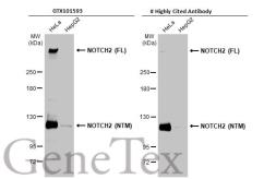 Anti-NOTCH2 antibody [C2], C-term used in Western Blot (WB). GTX101593