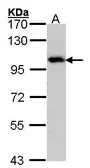 Anti-ADAM15 antibody [N1N2], N-term used in Western Blot (WB). GTX101599