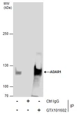 Anti-ADAR1 antibody [N3C1], Internal used in Immunoprecipitation (IP). GTX101602