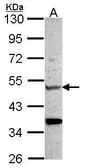 Anti-CHIT1 antibody [N3C3] used in Western Blot (WB). GTX101606