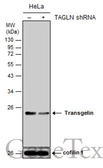 Anti-Transgelin antibody used in Western Blot (WB). GTX101608
