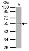 Anti-p62Dok antibody [N1C1] used in Western Blot (WB). GTX101610
