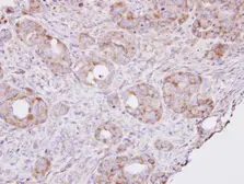 Anti-RPL8 antibody used in IHC (Paraffin sections) (IHC-P). GTX101614