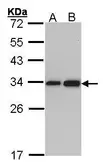 Anti-RPL8 antibody used in Western Blot (WB). GTX101614