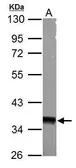 Anti-AMPK gamma 1 antibody used in Western Blot (WB). GTX101661