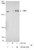 Anti-CHD4 antibody used in Immunoprecipitation (IP). GTX101662