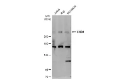 Anti-CHD4 antibody used in Western Blot (WB). GTX101662