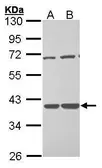 Anti-TSTA3 antibody [C1C3] used in Western Blot (WB). GTX101663