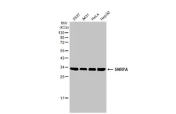 Anti-SNRPA antibody used in Western Blot (WB). GTX101664