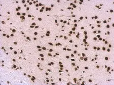 Anti-SNRPA antibody used in IHC (Paraffin sections) (IHC-P). GTX101664