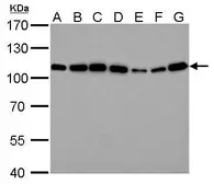Anti-alpha Actinin 4 antibody [C2C3], C-term used in Western Blot (WB). GTX101669