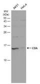 Anti-CDA antibody used in Western Blot (WB). GTX101673