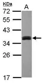 Anti-SULT1A3 antibody [N1C3] used in Western Blot (WB). GTX101675