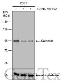 Anti-Calnexin antibody [N3C2], Internal used in Western Blot (WB). GTX101676