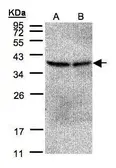 Anti-PP2A beta antibody used in Western Blot (WB). GTX101690