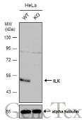 Anti-ILK antibody [N1C1] used in Western Blot (WB). GTX101691