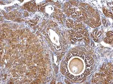 Anti-Septin 2 antibody [N1N3] used in IHC (Paraffin sections) (IHC-P). GTX101693