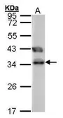 Anti-TTC1 antibody used in Western Blot (WB). GTX101698