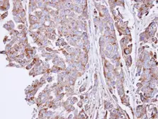 Anti-SGSH antibody [C1C3] used in IHC (Paraffin sections) (IHC-P). GTX101700