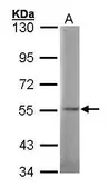 Anti-SGSH antibody [N1N3] used in Western Blot (WB). GTX101701