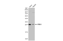 Anti-PRX I antibody [N1C2] used in Western Blot (WB). GTX101705