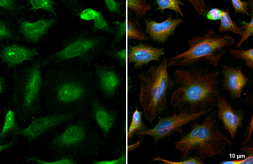 Anti-PRX I antibody [N1C2] used in Immunocytochemistry/ Immunofluorescence (ICC/IF). GTX101705