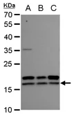 Anti-nm23-H2 antibody used in Western Blot (WB). GTX101706
