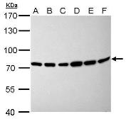 Anti-Moesin antibody [C2C3], C-term used in Western Blot (WB). GTX101708