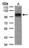 Anti-DAP5 antibody used in Western Blot (WB). GTX101710