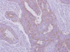 Anti-HGS antibody [C2C3], C-term used in IHC (Paraffin sections) (IHC-P). GTX101718