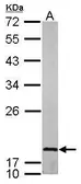 Anti-LMO1 antibody used in Western Blot (WB). GTX101726