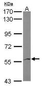 Anti-IMPDH2 antibody [N2C1], Internal used in Western Blot (WB). GTX101727