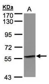 Anti-IMPDH2 antibody [N2C1], Internal used in Western Blot (WB). GTX101727