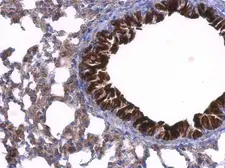 Anti-GDI1 antibody used in IHC (Paraffin sections) (IHC-P). GTX101731