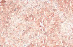 Anti-Ferritin Heavy Chain antibody [N1C3] used in IHC (Paraffin sections) (IHC-P). GTX101733