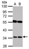 Anti-RASSF7 antibody used in Western Blot (WB). GTX101740