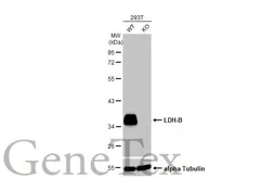 Anti-LDH-B antibody used in Western Blot (WB). GTX101747