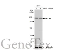 Anti-MYH9 antibody [N1], N-term used in Western Blot (WB). GTX101751