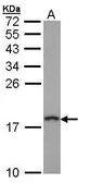 Anti-Prefoldin 5 antibody [N1C3] used in Western Blot (WB). GTX101752