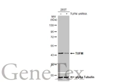 Anti-TUFM antibody used in Western Blot (WB). GTX101763
