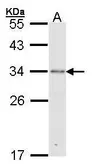 Anti-RPA32 antibody [N1C3] used in Western Blot (WB). GTX101765