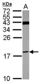 Anti-V-ATPase F antibody used in Western Blot (WB). GTX101768