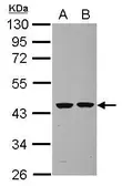 Anti-Septin 2 antibody used in Western Blot (WB). GTX101774