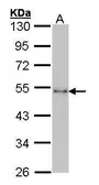 Anti-CtBP1 antibody [N3C3] used in Western Blot (WB). GTX101775