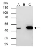 Anti-FEN1 antibody used in Immunoprecipitation (IP). GTX101777