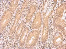 Anti-IMPDH2 antibody used in IHC (Paraffin sections) (IHC-P). GTX101778