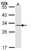 Anti-Proteasome beta 4 antibody [N1C3] used in Western Blot (WB). GTX101780